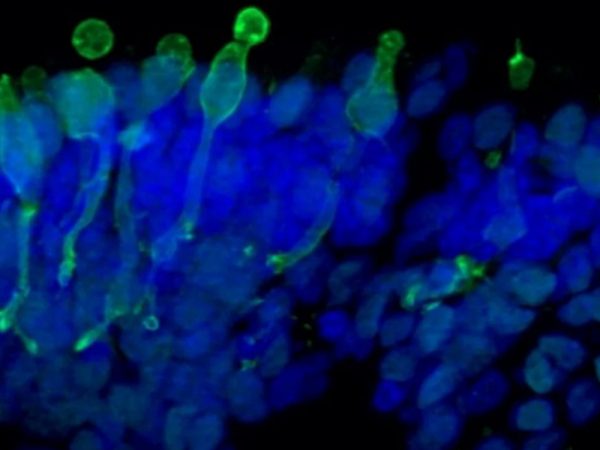 A microscope image of retinal organoids