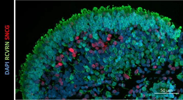 Tropism of AAV Vectors in Photoreceptor-Like Cells of Human iPSC-Derived Retinal Organoids