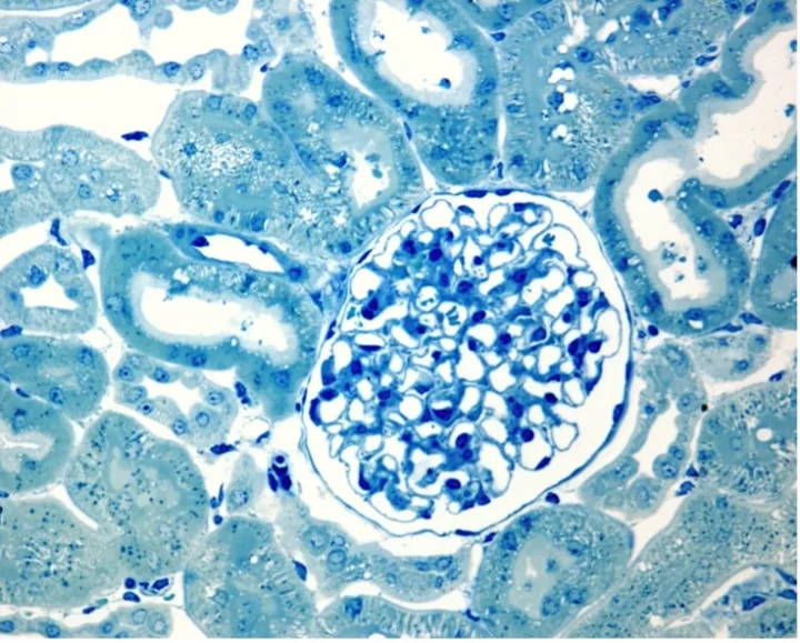 Glomerulus surrounded by convoluted tubules