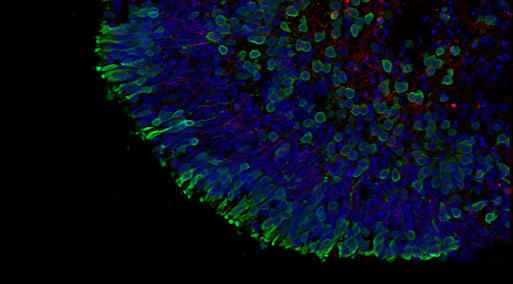 Newcells Biotech to develop 3D retinal organoids using hiPSC derived skin cells