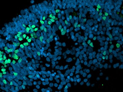 About retinal organoids