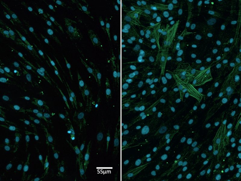 Fibroblasts to Myofibroblast transition