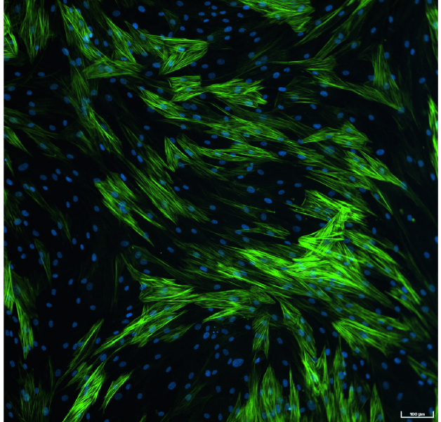 Fibroblasts to Myofibroblast transition