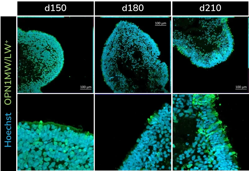 Cone photoreceptors