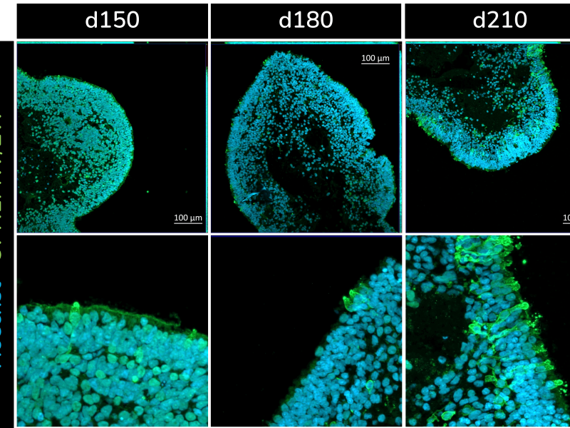 Cone photoreceptors