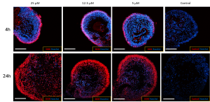 Retinal Toxicity 1