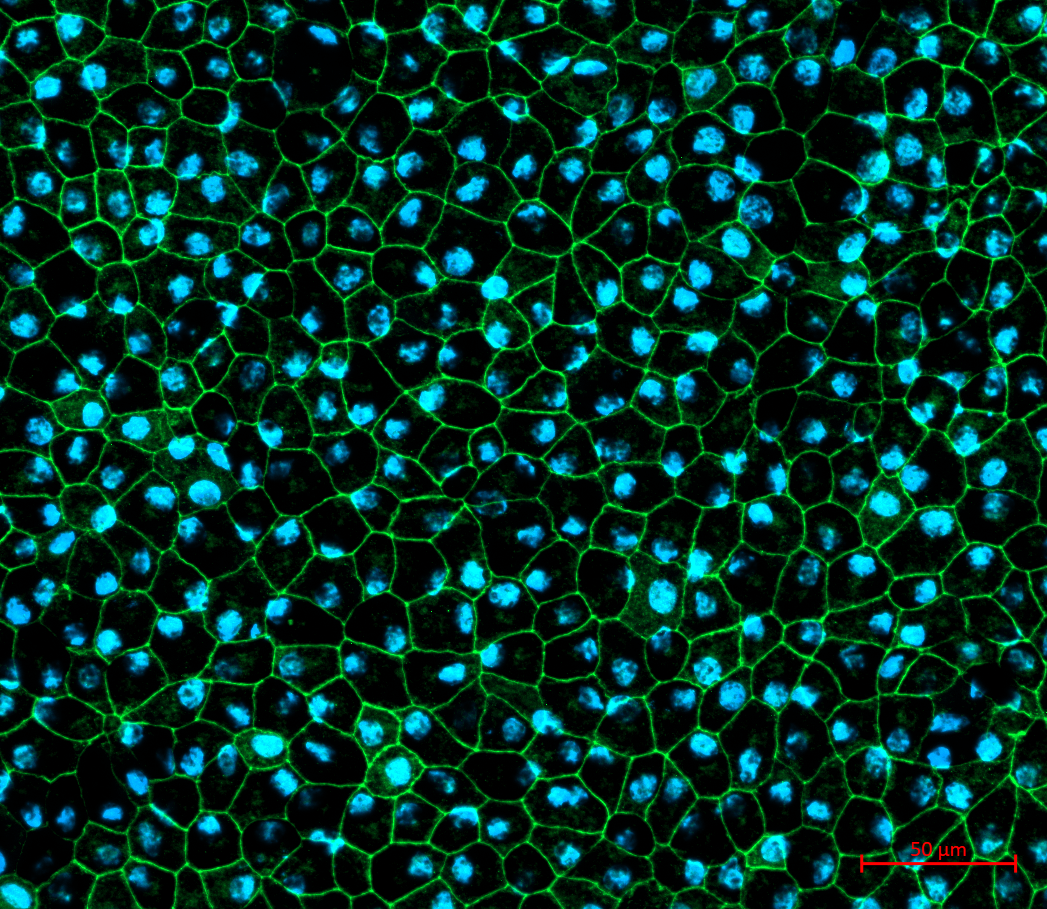 iPSC-derived retinal pigment epithelial (RPE) cells