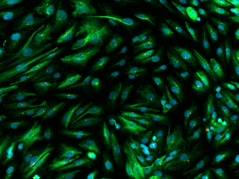 Isolated primary podocytes immunostained for cilia