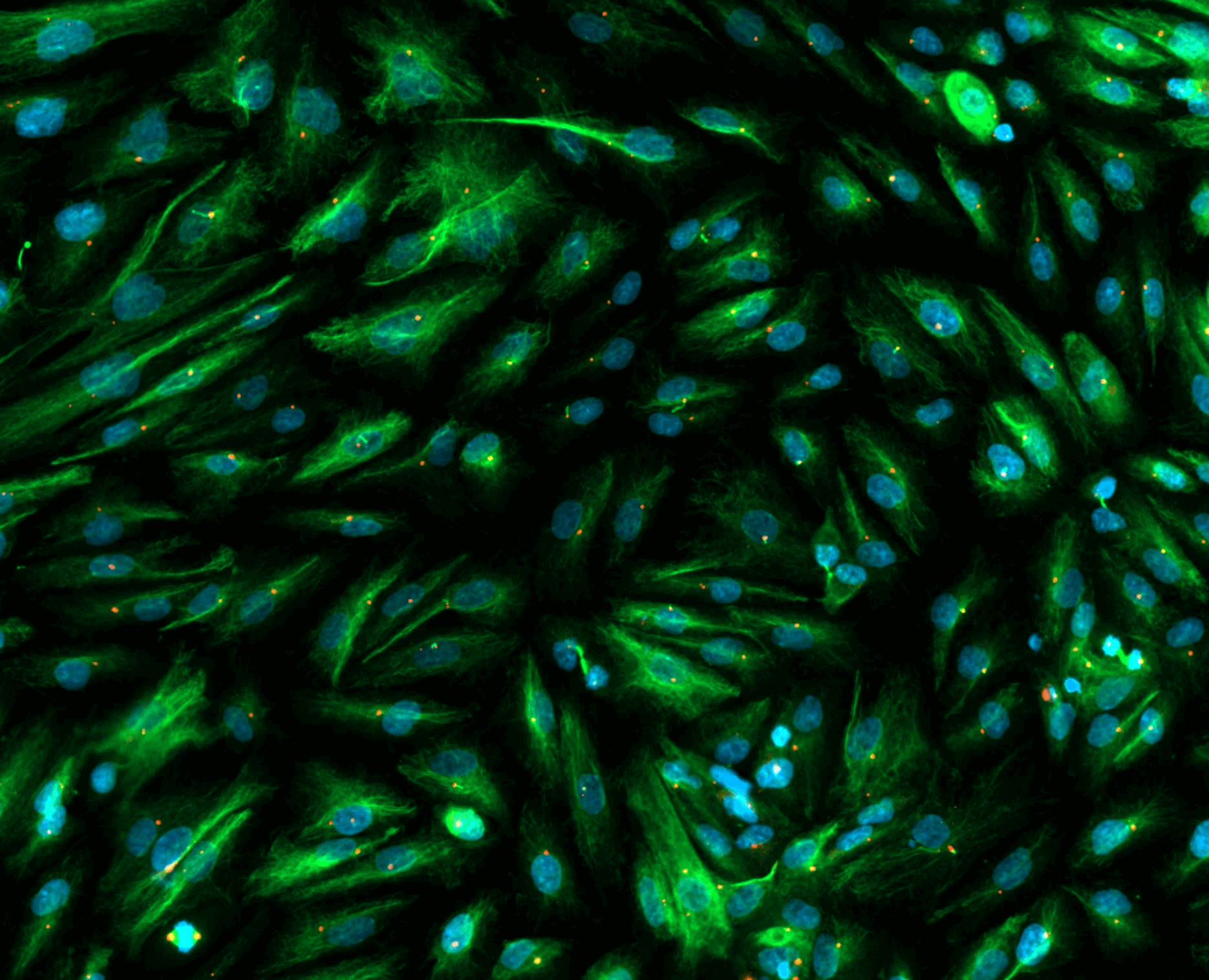 Isolated primary podocytes immunostained for cilia