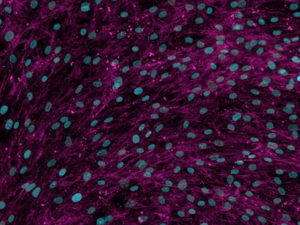 Human Lung Fibroblasts stimulated with TGF-β for 72 hours and immunostained to detect collagen I, as a measure of extracellular matrix production and deposition.