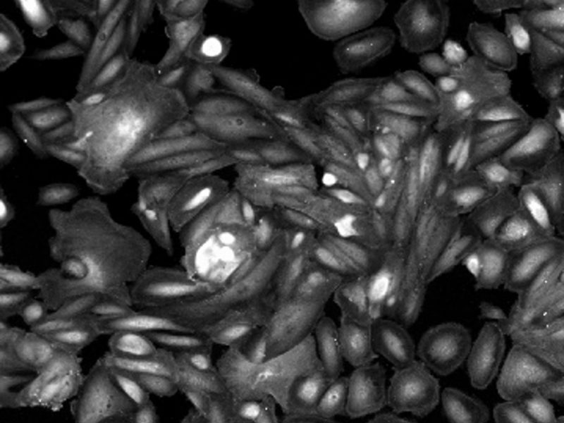 Primary isolated podocytes immunostained for Podocin