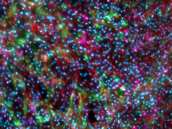 Small Airway Epithelial Cell Model